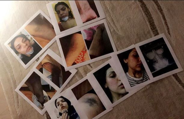 Ünlü oyuncunun eski sevgiliye şantaj davasında karar çıktı! - Resim : 2