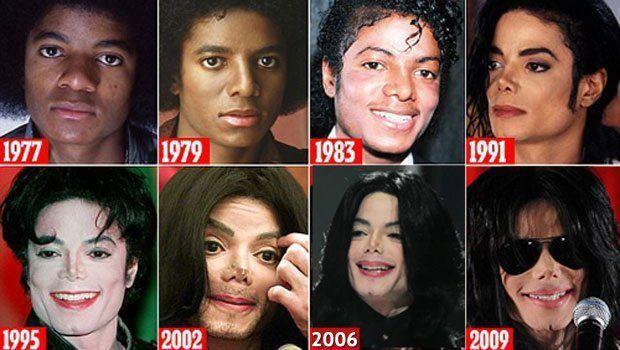 Dünya starı Mıchael Jackson'ın plastik cerrahından itiraflar