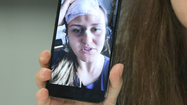 Göksel'in konserinde duyma yetisini yüzde 65 kaybetti: Tehdit edildim - Resim : 4