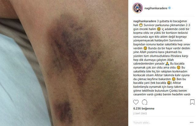 Survivor Nagihan'ı çıldırtan olay: Pis iftiralarınız bitmedi...