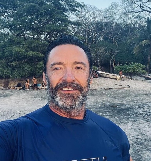 Ünlü oyuncu Hugh Jackman hayranlarını korkuttu: İki biyopsi yaptırdım, bunu benden duyun istedim