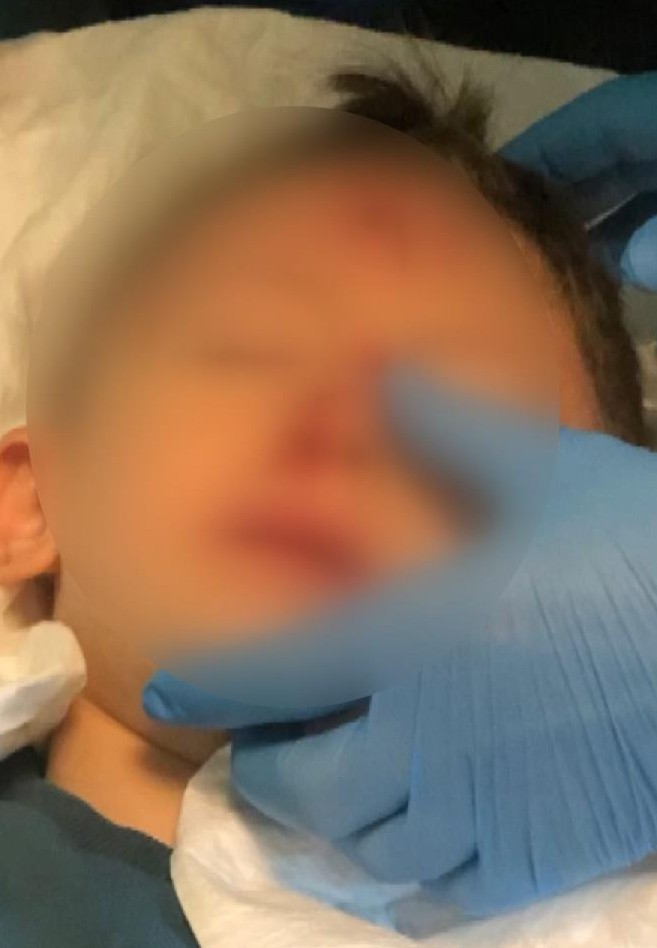 İstanbul'da kreşte korkunç ihmal! 5 yaşındaki çocuk, oyun oynarken inşaat alanına düştü