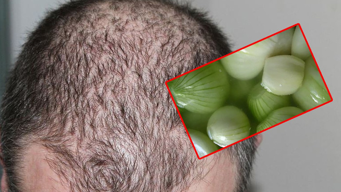 15 Dakikada Saç Çıkartmanın Tüyosu Ortaya Çıktı