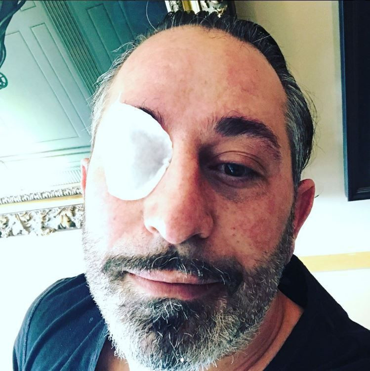 Cem Yılmaz'dan kötü haber! Gözüne ne oldu? - Resim : 2