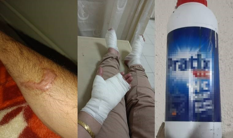 Lavabo açacağı faciası! Bomba gibi patladı