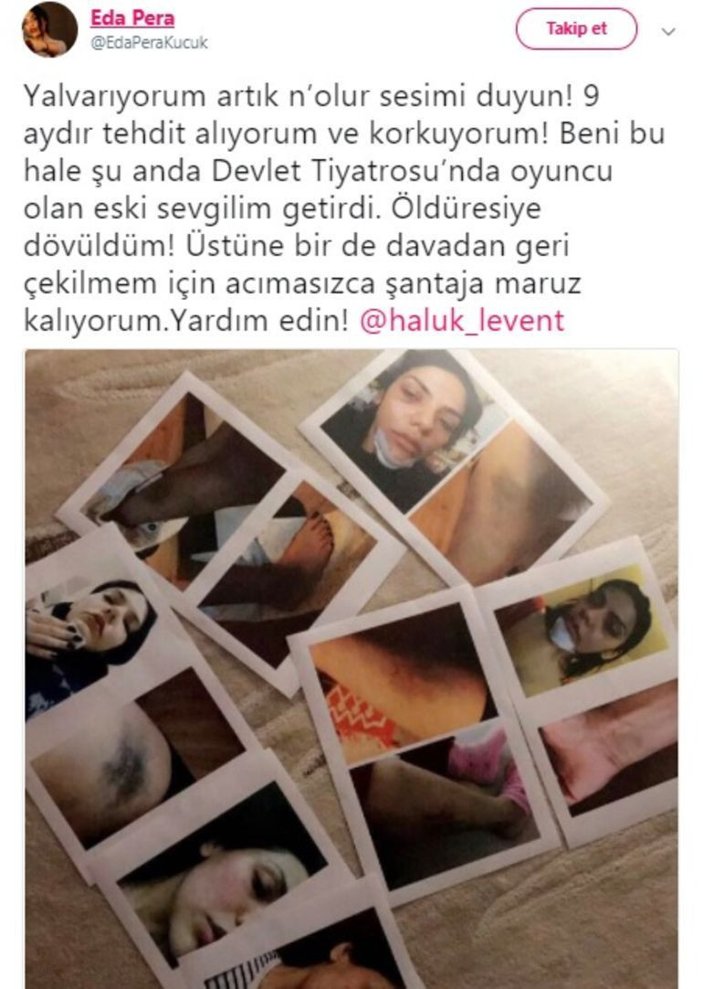 Ünlü oyuncunun adı şiddet davasına eklendi! - Resim : 2