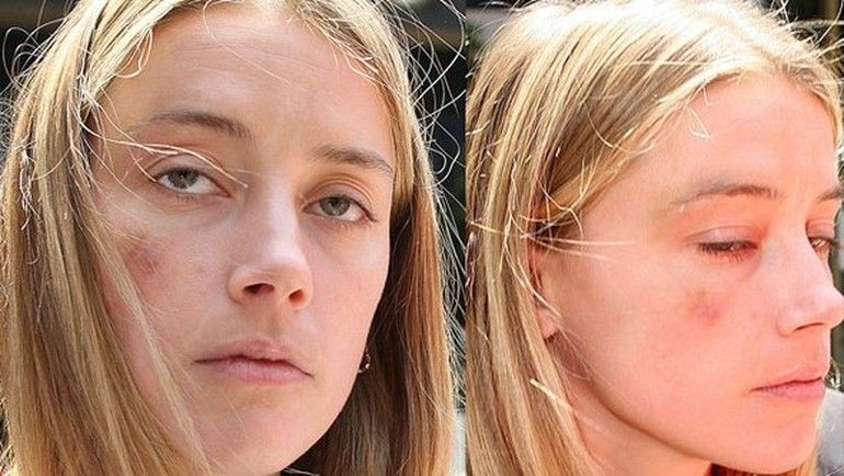 Johnny Depp’in biten evliliğinin ardından ilginç iddia! - Resim : 2