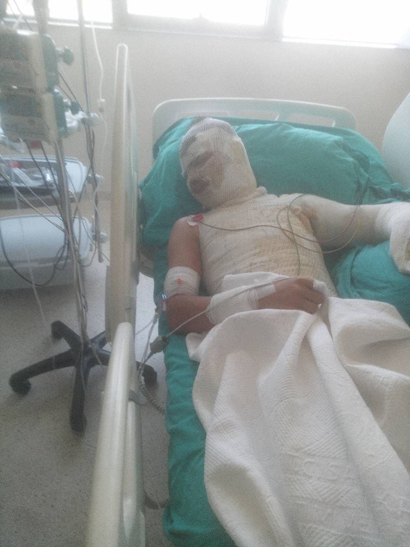 Adana'da akıllara durgunluk veren olay! 16 yaşındaki yeğenini yakan adamın yalanı dehşete düşürdü - Resim : 2