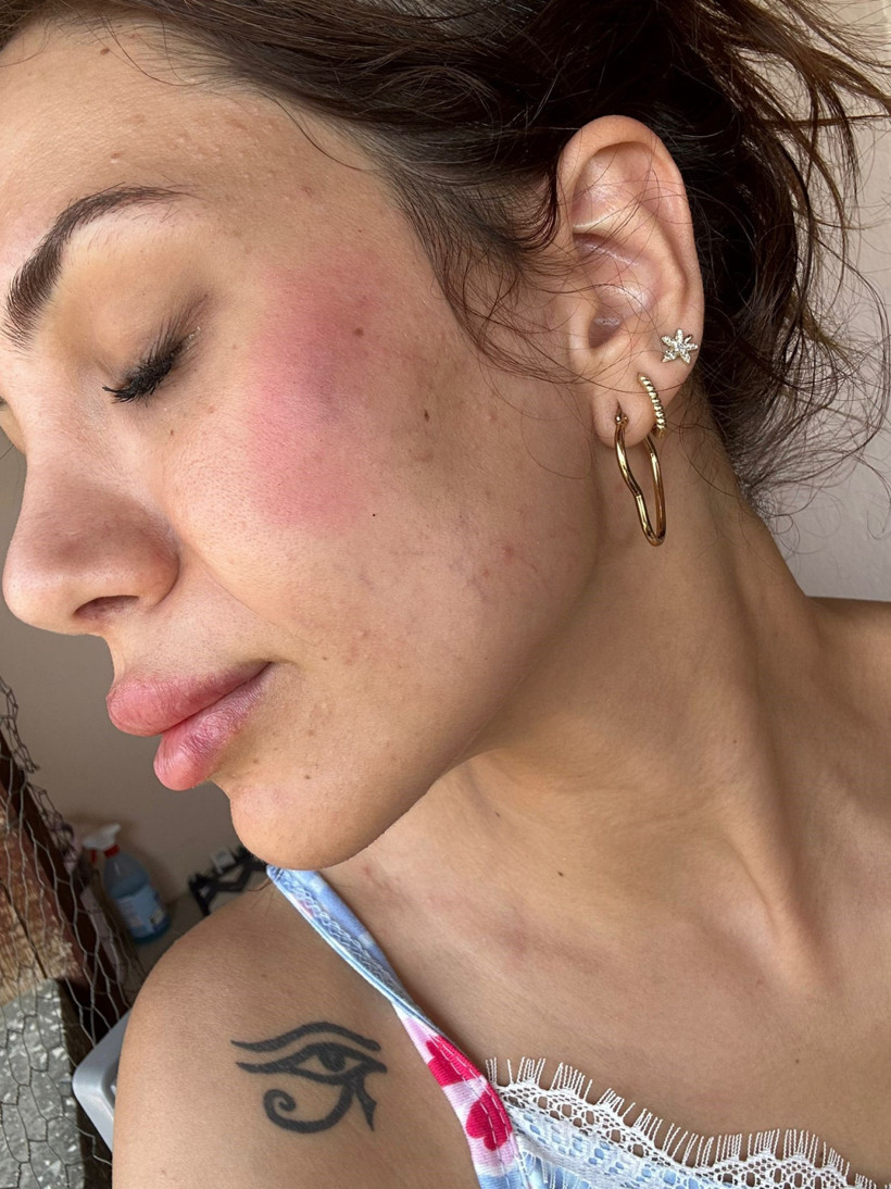 Köpek besledi dehşeti yaşadı! Komşuları tarafından darp edildi