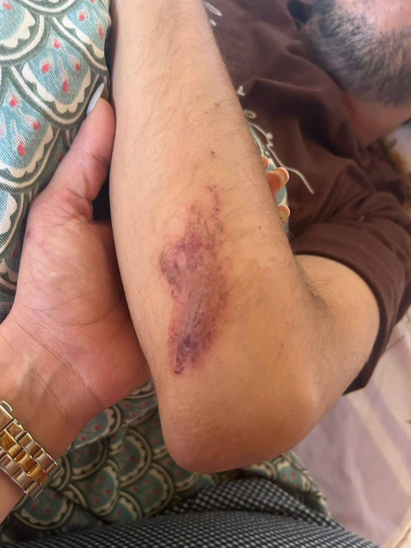 Köpek besledi dehşeti yaşadı! Komşuları tarafından darp edildi - Resim : 2