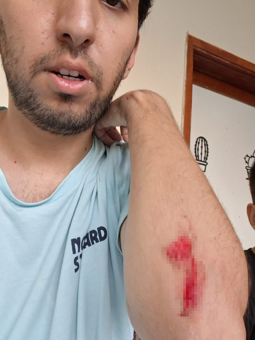 Köpek besledi dehşeti yaşadı! Komşuları tarafından darp edildi - Resim : 3