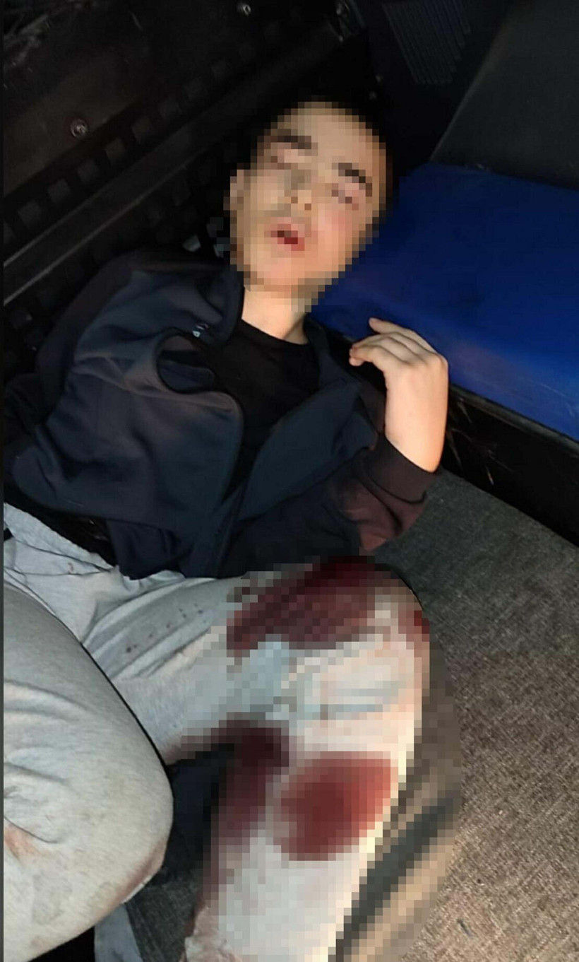 Karakol saldırısında şehit sayısı 3'e yükseldi - Resim : 6