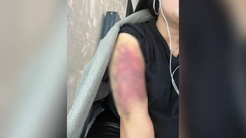 İstanbul'da erkek vahşeti! Eski kız arkadaşına dehşeti yaşattı serbest kaldı