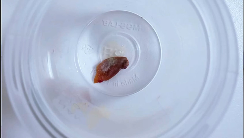 Öksürük şikayetiyle gitmişti: Ardından çıkan gerçek şoke etti!