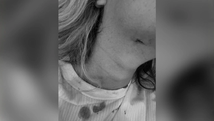 İstanbul'da erkek vahşeti! Eski kız arkadaşına dehşeti yaşattı serbest kaldı - Resim : 2