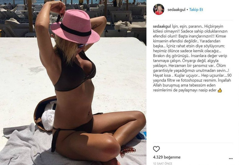 Seda Akgül'den cesur paylaşım - Resim : 2