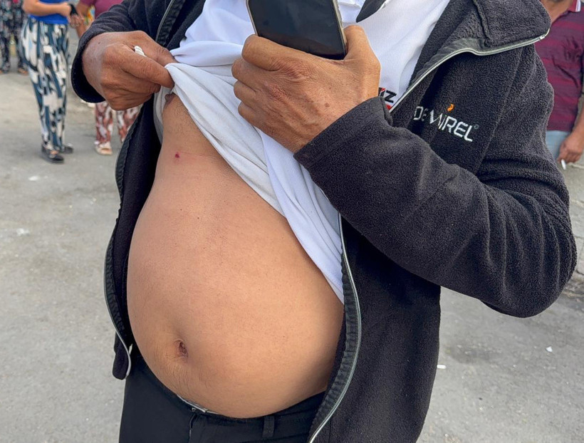 Husumetli aileler dehşet saçtı! Yaralılar var - Resim : 3