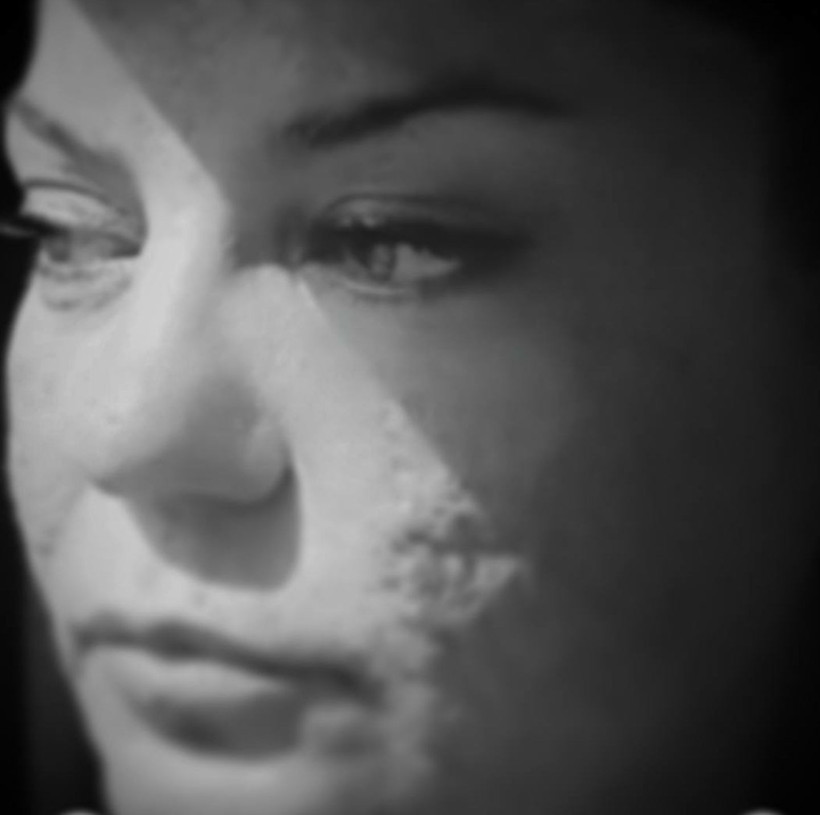 Yüzündeki izleri ilk kez yakından paylaştı, takipçilerinden destek yağdı