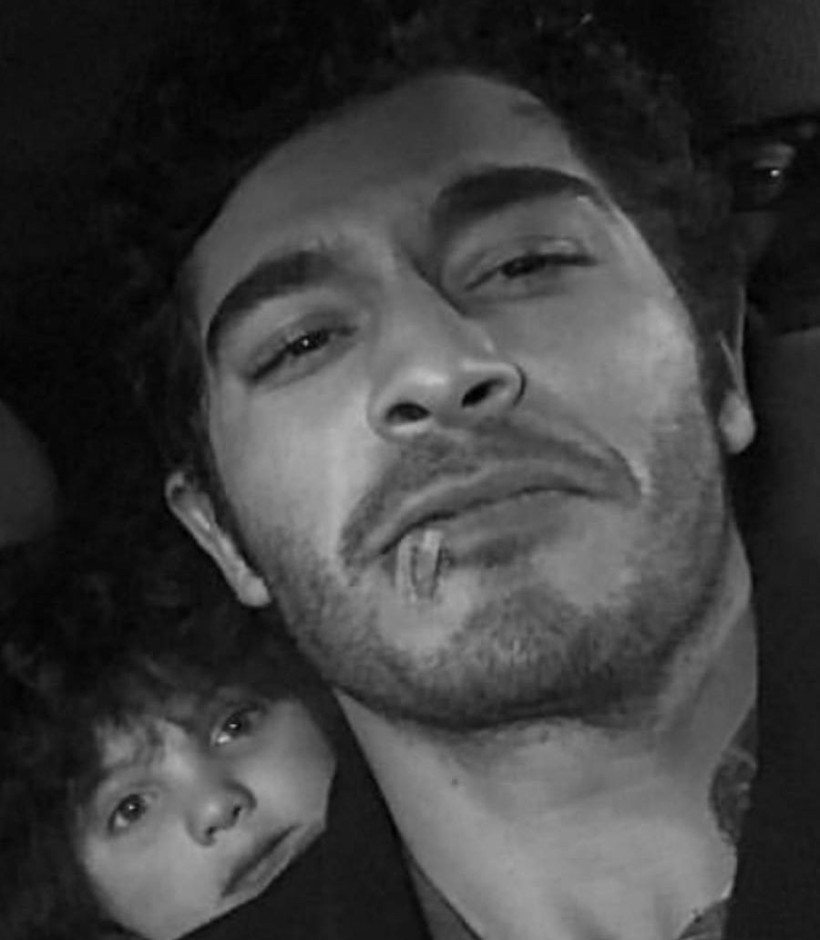 Dudağını köpek ısıran Burak Deniz, son halini paylaştı!